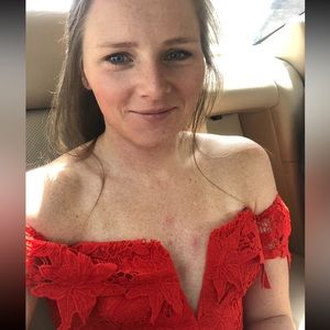 Astr The Label Hot Red Dress